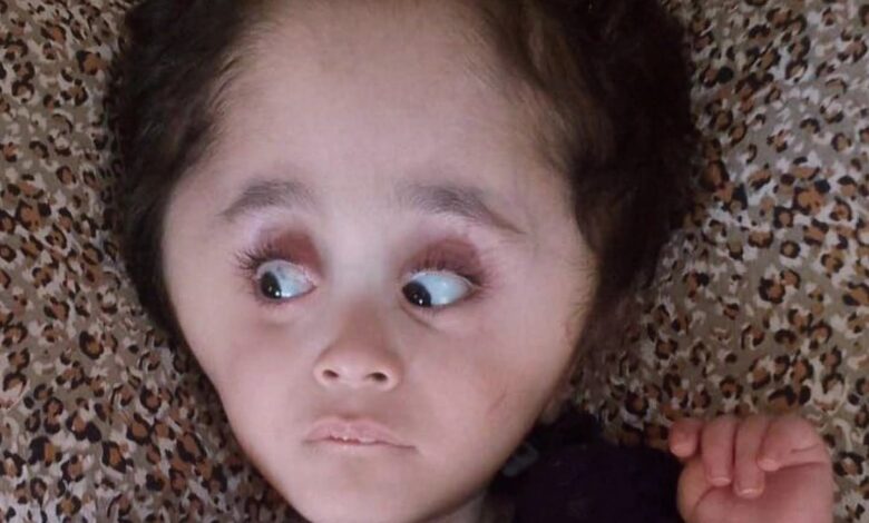 مأساة الطفل عبد الله