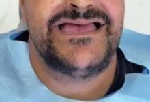 القبض