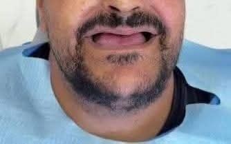 القبض